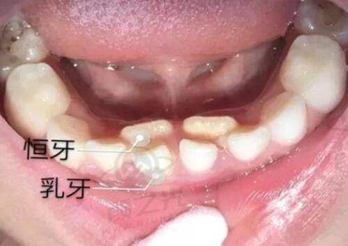二、深圳去眼袋的正规医院排行榜前三名