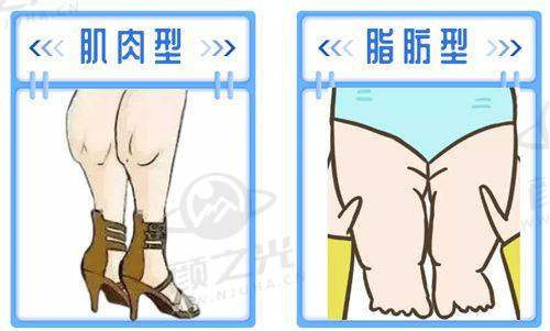 乔雅登玻尿酸丰脸多少钱一针？不同型号价格大揭秘，效果与费用全解析！ 