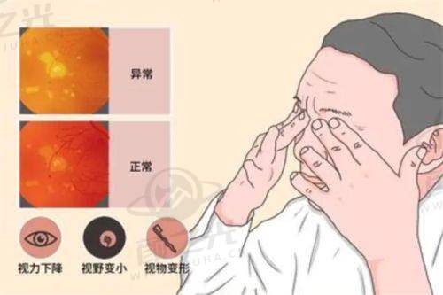 三、潍坊明润眼科医院指导申请步骤及流程