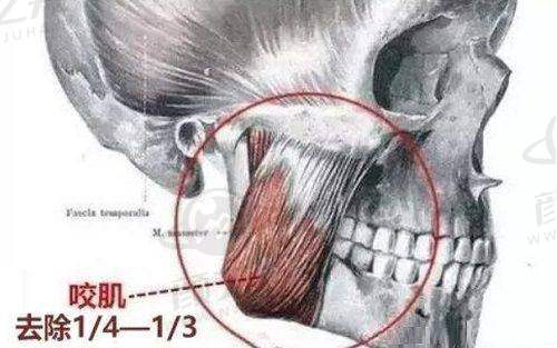 杭州维多利亚医疗美容医院收费贵吗？多项目价格透明，实际收费依情况而定 