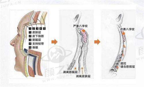 【超全攻略】北京京城皮肤医院就诊指南，含地址、交通、预约挂号！ 