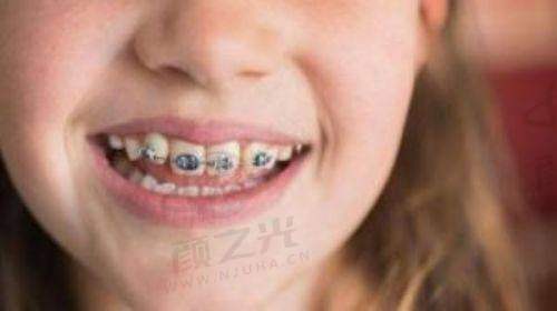 三、上海博厚口腔医院设备精良吗?