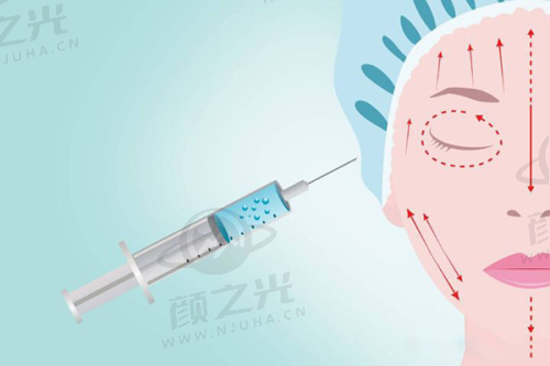 王俞花擅长项目列表