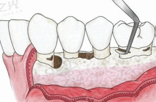 六、兰州海涛口腔医院地址及乘车方式