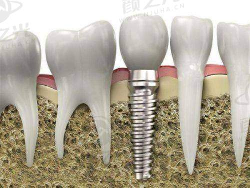 兰州海涛口腔医院怎么预约挂号？电话、网络、现场三种方式全攻略，建议收藏！ 