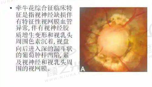 无锡华厦眼科医院简介