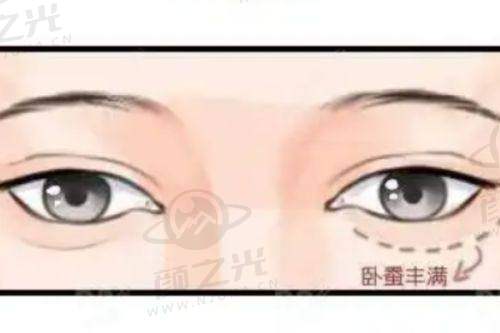 李晓东筋膜提升手术成效真有那么好?