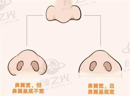 林登文医生现在在哪上班？创举美眼术，超吸睛！