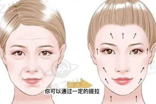沈阳北方整形隆鼻怎么样?高国林、田明礼技术特点揭秘,2万-3.5万打造自然美鼻!