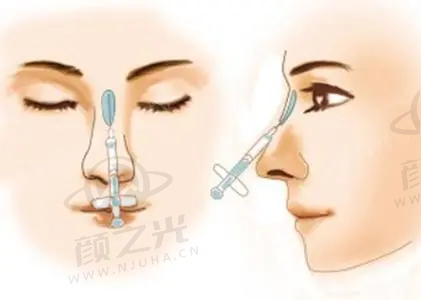 30年临床经验,怎么打造自然美胸?