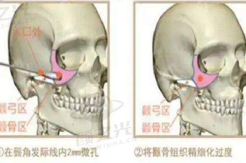 北京三仁周敏茹简介简历介绍：24年医美经验，抗衰塑形技术强，价格500元起！ 