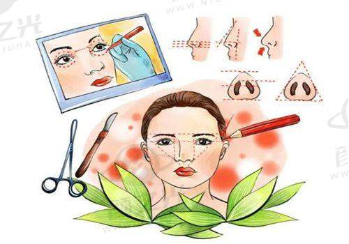 石家莊雅芳亞價目表出爐：埋線雙眼皮 2000 起、假體隆鼻 5000 起，5A 級醫院價格透明
