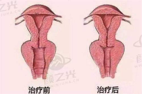 广州整形医生姬付康在和同行比优势在哪?