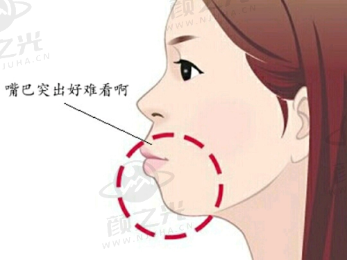 杜园园官网预约 —— 适合详细沟通,提前传递眼部情况