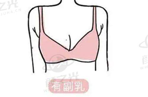 不同类型疤痕该找哪位医生?