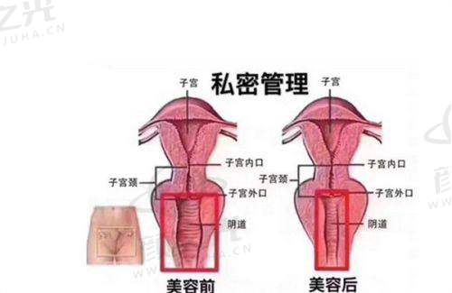 三、深圳米兰柏羽钟伟洪减肥的好评（面部吸脂真实实例）