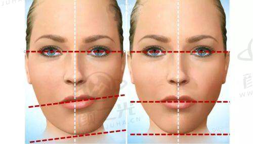 国内东莞整形市场有啥参考?