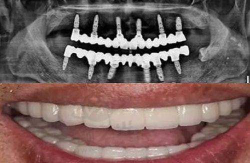 上海夜晚牙疼别犯愁！这5家夜间牙科急诊医院为你排忧解难 