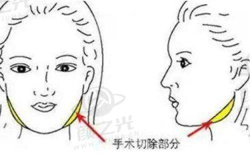 三、广州曙光医学美容医院——大型连锁集团
