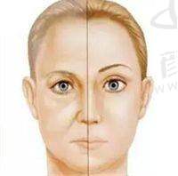 想在赣州吸脂抽脂？这三家实力整形机构大揭秘，效果超惊艳！ 