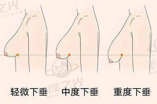 2025北京靠谱整容医院前十揭晓！圣嘉新磨骨、加减美拉皮等各有所长 