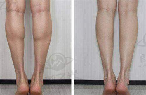 十、广州广大整形美容医院:特色领域的专精之选