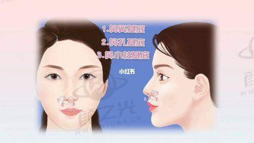 五、广州华美医疗美容医院——热门整形选择