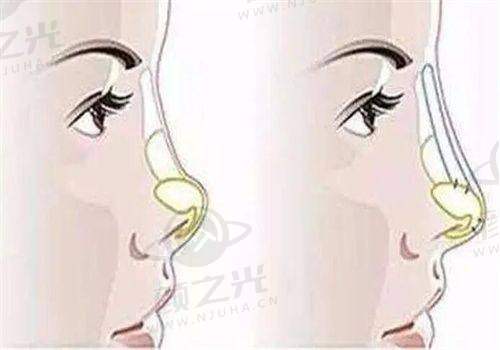 三、广州华美医疗美容医院:老牌医院的深厚底蕴