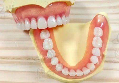 三、衢州蓝芽口腔收费大公开