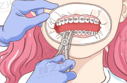 清远嘉悦口腔交通路线