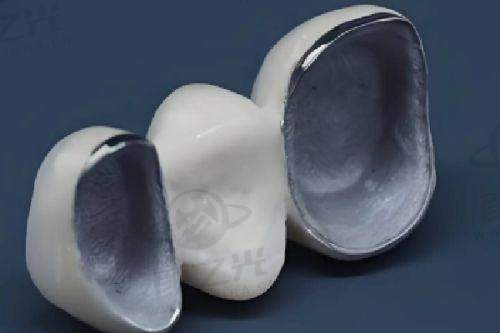 衢州雅医、爱瑞等四家口腔收费大揭秘！种牙矫正费用全知晓 