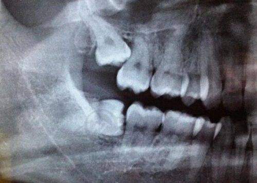 常州张氏口腔门诊部价格参考