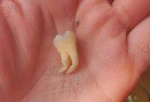 徐州十大正规靠谱口腔医院推荐！助你快速找到便宜又好的牙科 