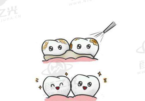 兰州皓正口腔诊所核心项目