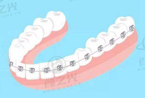 四、衢州市牙科收费一览