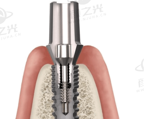 清远嘉悦口腔医生团队