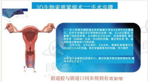 五、广州紫馨美容医院:专精科室的全方面保护