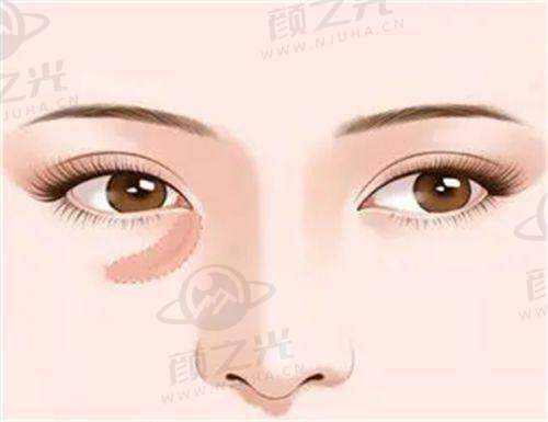 八、广州军美医疗美容门诊部:精细整形的独特魅力