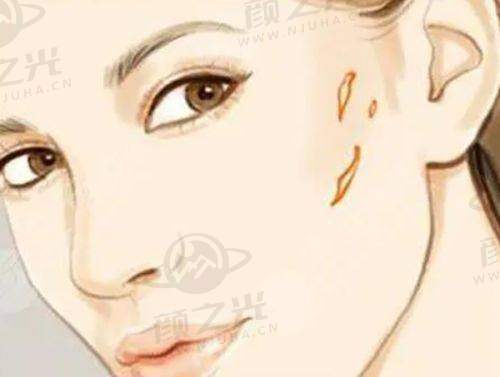 五、北京米兰柏羽丽都整形美容医院——耳再造具有影响力