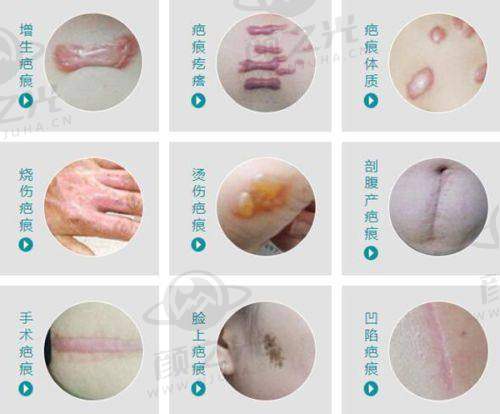 五、成都懿和丰德医学美容门诊部优惠推荐