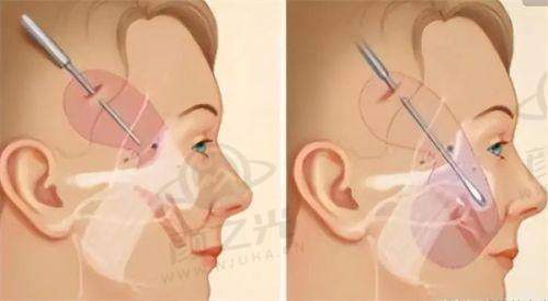 二、赣州虔美医疗美容门诊部——专注服务与技术的贴心之选