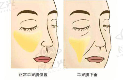 重庆当代整形医院收费亲民!磨骨2.5万起,年关优惠低至1999元起!