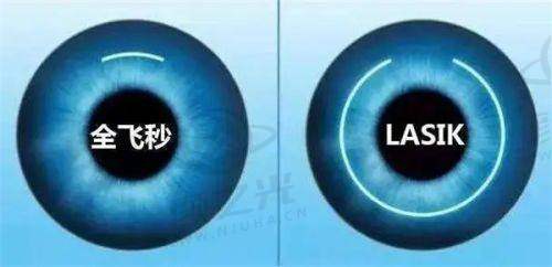 五、江门眼科收费标准