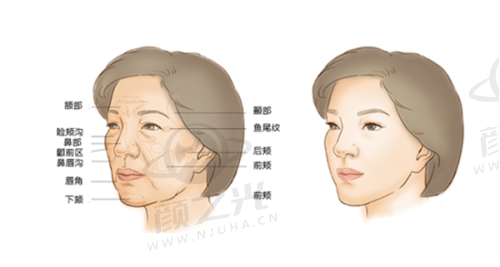 九、广东美恩医疗整形美容医院——胸整形修复佳选