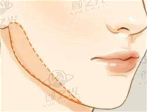 二、广州艺星医疗美容医院:个性化服务的佼佼者