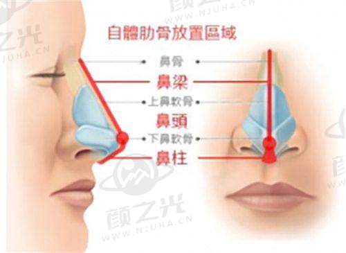佛山曙光王栋医生:近十年整形经验,擅长多类手术,速来了解!