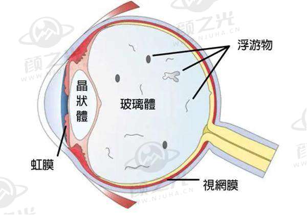 泉州艾格眼科医院正规资质