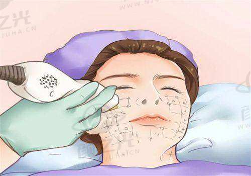 【深圳整形曹孟君医生测评】多项专长口碑佳，技术靠谱助你实现美丽梦想！ 