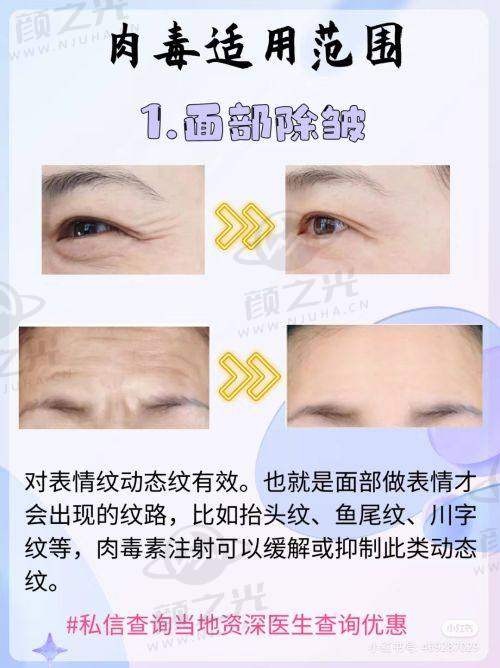 想变美怕踩坑?昆明韩辰医美,多项目诊疗、专业医生团队等你来!