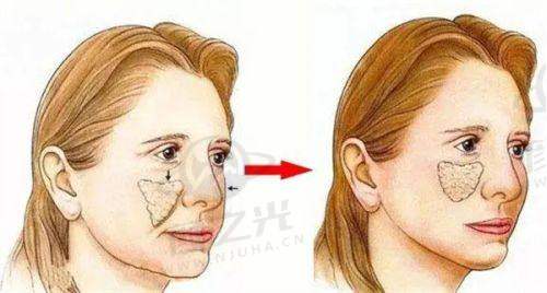 四、真实患者反馈